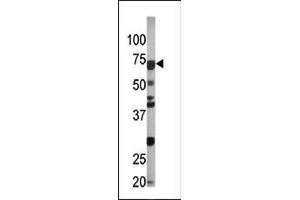The anti-Phospho-CDC6-S54 Pab (ABIN389537 and ABIN2839584) is used in Western blot to detect Phospho-CDC6-S54 in Ramos tissue lysate (CDC6 抗体  (pSer54))