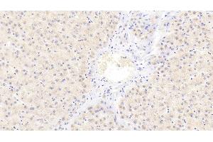 Immunohistochemistry (IHC) image for anti-Complement Fragment 3a (C3a) (AA 672-748) antibody (ABIN7439951)
