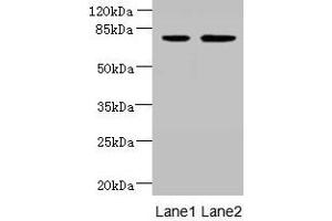 Western blot All lanes: ARMC9 antibody at 6 μg/mL Lane 1: Jurkat whole cell lysate Lane 2: CEM whole cell lysate Secondary Goat polyclonal to rabbit IgG at 1/10000 dilution Predicted band size: 92, 76 kDa Observed band size: 76 kDa (ARMC9 抗体  (AA 401-665))