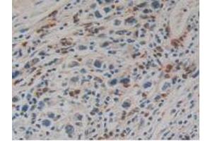 Figure. (Kallikrein 10 抗体  (AA 35-276))