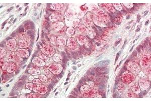 Detection of GLa in Human Small intestine Tissue using Polyclonal Antibody to Galactosidase Alpha (GLa)