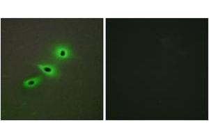 Immunofluorescence (IF) image for anti-Cytochrome P450, Family 19, Subfamily A, Polypeptide 1 (CYP19A1) (AA 221-270) antibody (ABIN2889935) (Aromatase 抗体  (AA 221-270))