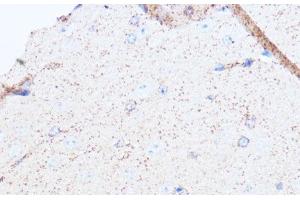 Immunohistochemistry of paraffin-embedded Mouse brain using MAOA Polyclonal Antibody at dilution of 1:100 (40x lens).