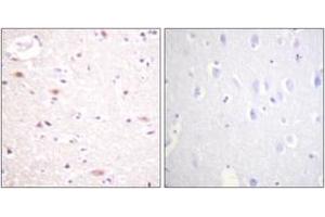Immunohistochemistry analysis of paraffin-embedded human brain, using CDC16/APC6 (Phospho-Ser560) Antibody. (CDC16 抗体  (pSer560))