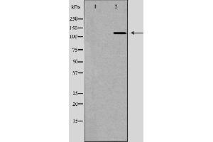 Western blot analysis of Hela whole cell lysates, using IPO5 Antibody. (Importin 5 抗体)