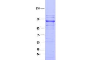 Western Blotting (WB) image for Ephrin Type A Receptor 1 (EPHA1) protein (DYKDDDDK Tag) (ABIN2720227)