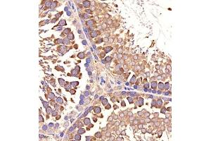 Immunohistochemistry of paraffin embedded rat testis using p1d1 (ABIN7075069) at dilution of 1:2000 (400x lens) (PLD1 抗体)