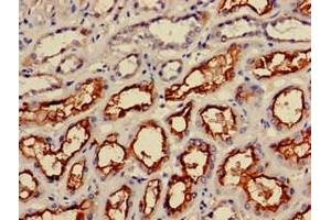 Immunohistochemistry of paraffin-embedded human kidney tissue using ABIN7156336 at dilution of 1:100 (IRS2 抗体  (AA 766-1001))