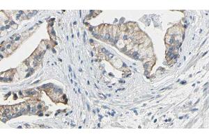 ABIN6272608 at 1/100 staining Human prostate tissue by IHC-P. (NPR1 抗体  (Internal Region))