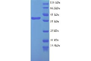 SDS-PAGE (SDS) image for Wilms Tumor 1 (WT1) (AA 147-446), (partial) protein (His tag) (ABIN5712782)