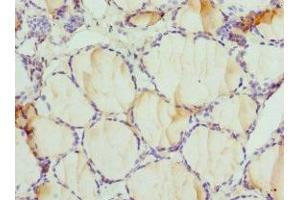 Immunohistochemistry of paraffin-embedded human thyroid tissue using ABIN7149983 at dilution of 1:100 (DPP3 抗体  (AA 1-280))