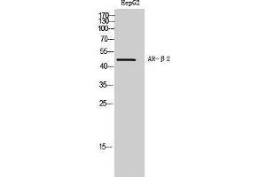 Western Blotting (WB) image for anti-Androgen Receptor beta 2 (C-Term) antibody (ABIN3183393) (Androgen Receptor beta 2 抗体  (C-Term))