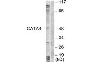 Western Blotting (WB) image for anti-GATA Binding Protein 4 (GATA4) (AA 228-277) antibody (ABIN2888839) (GATA4 抗体  (AA 228-277))