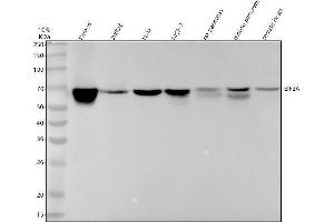 Western blot analysis of EIF2A using anti-EIF2A antibody (ABIN7604729).
