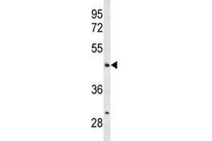 Western Blotting (WB) image for anti-Angiopoietin-Like 4 (ANGPTL4) (AA 138-167) antibody (ABIN3029955)