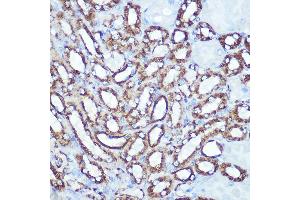 Immunohistochemistry of paraffin-embedded mouse kidney using HK1 Rabbit mAb (ABIN7267638) at dilution of 1:100 (40x lens). (Hexokinase 1 抗体)