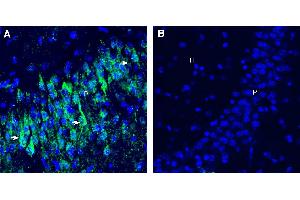 Expression of CD9 in mouse hippocampus. (CD9 抗体  (Extracellular))