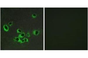 Immunofluorescence analysis of COS7 cells, using HTR2B Antibody.