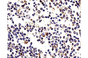 Immunohistochemistry analysis of paraffin-embedded human tonsil using COX4I1 Polyclonal Antibody at dilution of 1:200. (COX IV 抗体)
