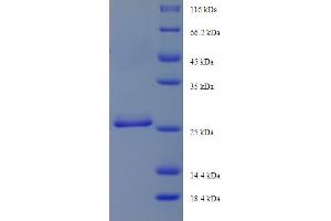 SDS-PAGE (SDS) image for Dynein, Light Chain, Roadblock Type 1 (DYNLRB1) (AA 3-96), (partial) protein (His-SUMO Tag) (ABIN5711787)