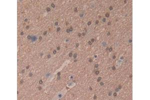 Used in DAB staining on fromalin fixed paraffin- embedded brain tissue (RNASEH2A 抗体  (AA 1-299))