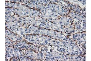 Image no. 2 for anti-Low Density Lipoprotein Receptor Adaptor Protein 1 (LDLRAP1) antibody (ABIN1496685) (LDLRAP1 抗体)