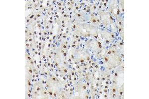 Immunohistochemistry of paraffin-embedded mouse kidney using SF3B3/S Rabbit mAb (ABIN7270544) at dilution of 1:100 (40x lens). (SF3B3 抗体)