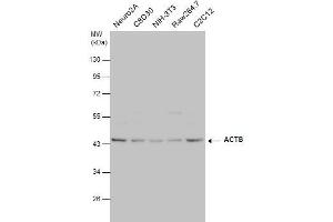 WB Image beta Actin antibody detects beta Actin protein by western blot analysis.