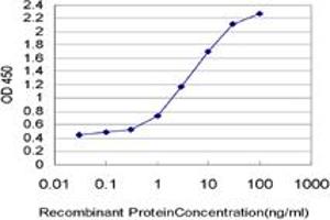 Detection limit for recombinant GST tagged MARCH7 is approximately 0. (MARCH7 抗体  (AA 66-136))