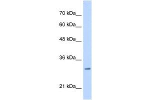 MLF2 antibody used at 0. (MLF2 抗体  (C-Term))