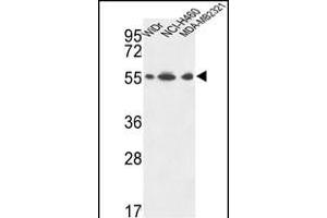 ATP5A1 Antibody (C-term) (ABIN653734 and ABIN2843039) western blot analysis in WiDr,NCI-,MDA-M cell line lysates (35 μg/lane). (ATP5A1 抗体  (C-Term))