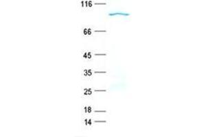 Western Blotting (WB) image for Fc Receptor-Like 1 (FCRL1) protein (GST tag,His tag) (ABIN5505634)