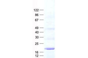 Validation with Western Blot (SEC11A Protein (His tag))