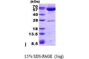 Image no. 1 for Glutamic Pyruvate Transaminase (Alanine Aminotransferase) 2 (GPT2) (AA 1-523) protein (His tag) (ABIN7280106)