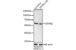 Western blot analysis of extracts from normal (control) and SYVN1 knockout (KO) 293T cells, using SYVN1 antibody (ABIN1680347, ABIN3016314, ABIN3016315 and ABIN6219717) at 1:1000 dilution. (SYVN1 抗体  (C-Term))