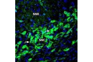 Immunohistochemistry (IHC) image for anti-Transient Receptor Potential Cation Channel, Subfamily M, Member 2 (TRPM2) (AA 999-1012), (Extracellular) antibody (ABIN7043831)