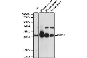 Western blot analysis of extracts of various cell lines, using INSIG2 antibody (ABIN6291415) at 1:1000 dilution.
