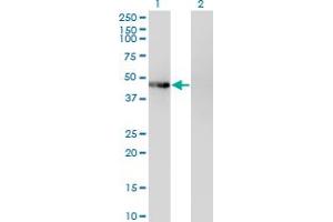 Western Blot analysis of PHKG2 expression in transfected 293T cell line by PHKG2 monoclonal antibody (M04), clone 2F4.