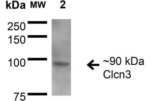 CLCN3 抗体  (AA 98-115)