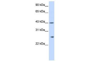 GSTK1 antibody used at 1 ug/ml to detect target protein. (GSTK1 抗体  (N-Term))