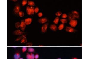 Immunofluorescence analysis of HeLa cells using ABCB7 Polyclonal Antibody at dilution of 1:100 (40x lens). (ABCB7 抗体)