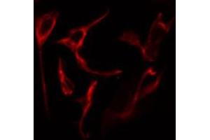 Immunofluorescence (fixed cells) (IF/ICC) image for anti-zeta-Chain (TCR) Associated Protein Kinase 70kDa (ZAP70) (pTyr319) antibody (ABIN6255884)