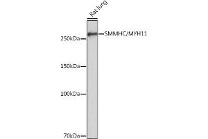 Western blot analysis of extracts of Rat lung, using SMMHC/SMMHC/MYH11 Rabbit mAb (ABIN7268745) at 1:1000 dilution. (MYH11 抗体)
