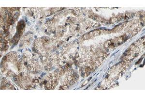 Immunohistochemistry (IHC) image for anti-Phosphatidylinositol-4-Phosphate 3-Kinase, Catalytic Subunit Type 2 gamma (PIK3C2G) (C-Term) antibody (ABIN6264209)