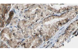 ABIN6272607 at 1/100 staining Human prostate tissue by IHC-P. (PIK3C2G 抗体  (C-Term))