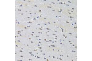 Immunohistochemistry of paraffin-embedded rat brain using PRPF3 Antibody.