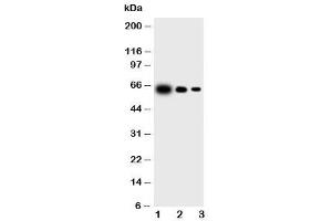 Western blot testing of IL23 p19 antibody and Lane 1:  recombinant mouse protein 10ng (IL23A 抗体  (N-Term))