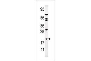 Western blot analysis of anti-AK1 Pab (ABIN392794 and ABIN2842231) in Jurkat cell line lysate (35 μg/lane). (Adenylate Kinase 1 抗体  (N-Term))