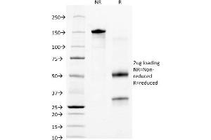 SDS-PAGE Analysis of Purified CKRT18 Mouse Monoclonal Antibody ABIN6383865. (Cytokeratin 18 抗体)