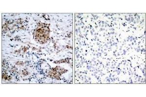 Immunohistochemistry (IHC) image for anti-Estrogen Receptor 1 (ESR1) (pSer167) antibody (ABIN7138448)